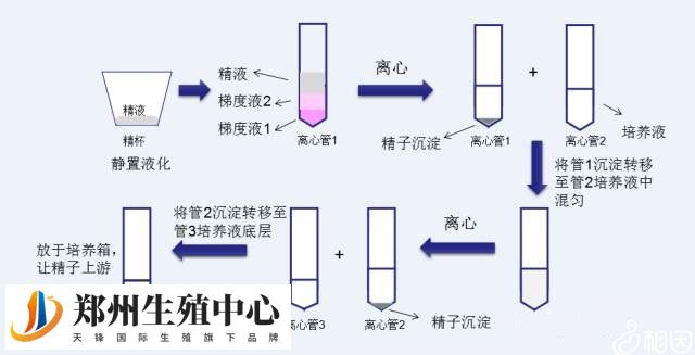 什么是洗精术？