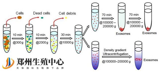 XY精子分离术流程图