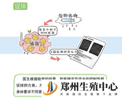 试管婴儿促排卵