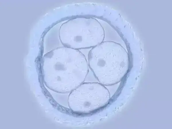 试管婴儿移植前要多注意休息