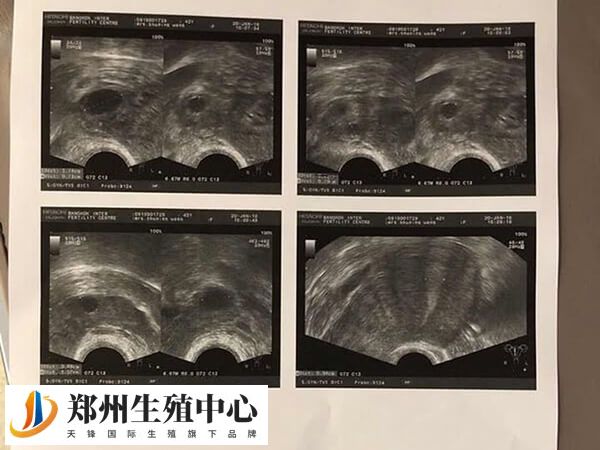 amh数值表示卵巢储备功能