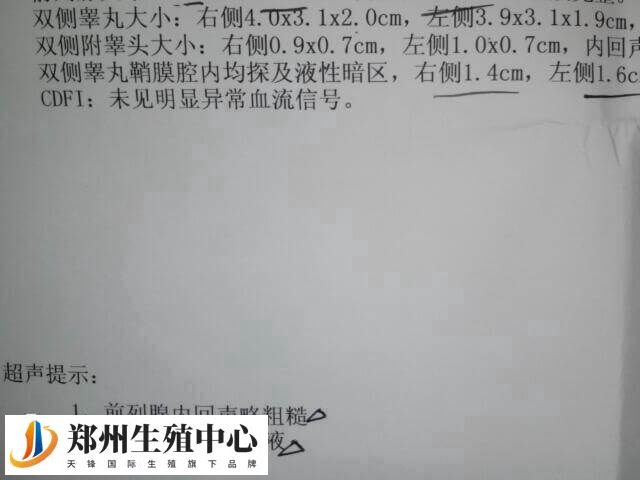 睾丸鞘膜积液可能影响生育能力