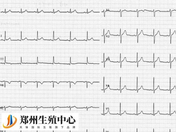 先天性窦性心律不齐会严重到影响试管婴儿移